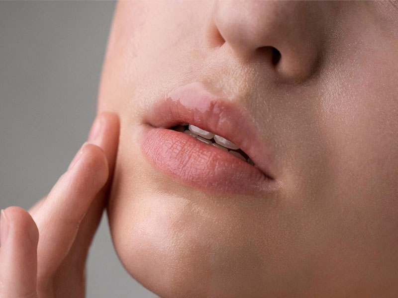 BB-Lips