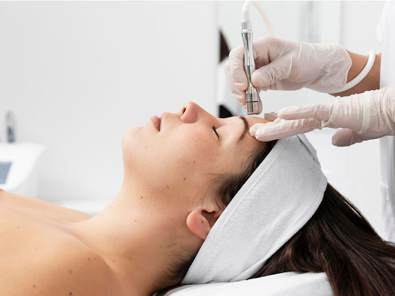 Diamant Microdermabrasion